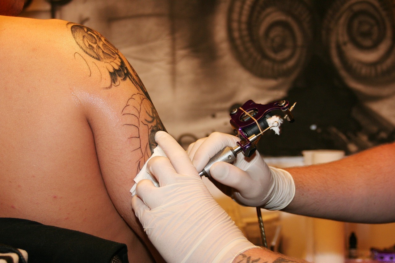 Usuwanie tatuaży
